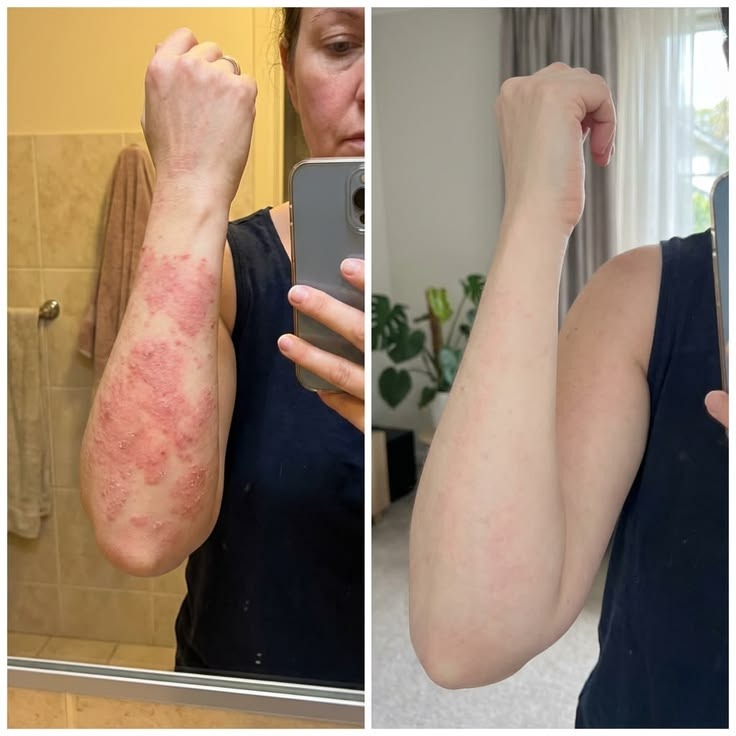 Patient treatment result