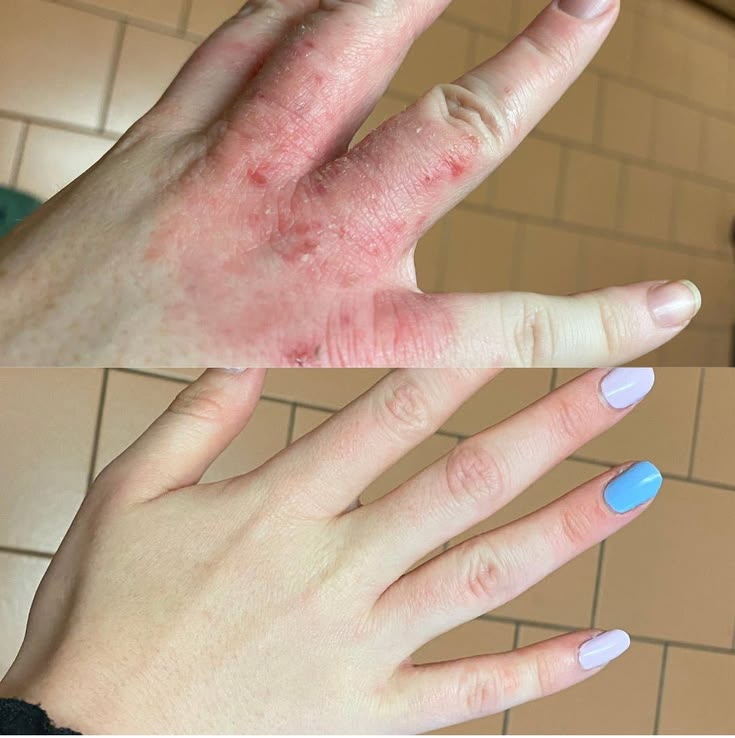 Patient treatment result
