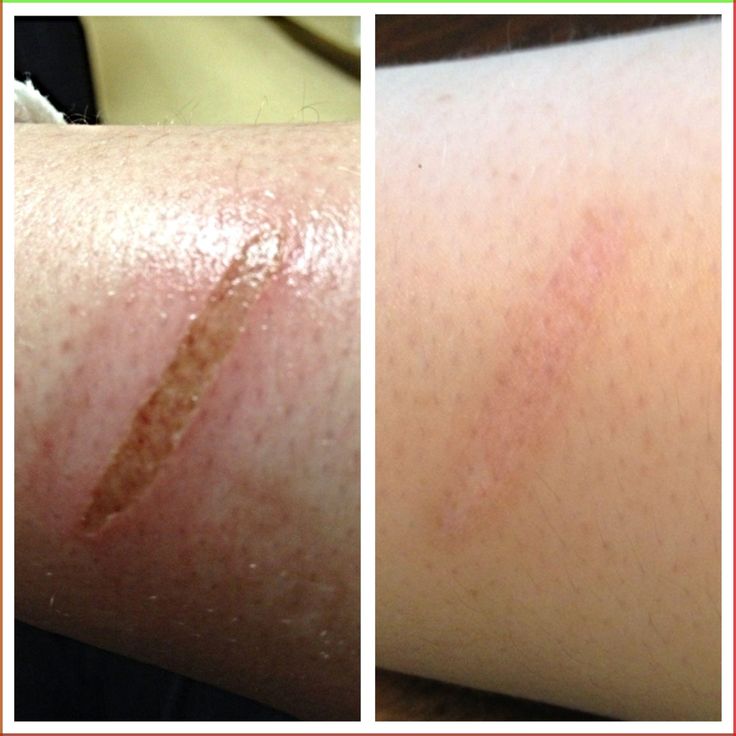 Patient treatment result